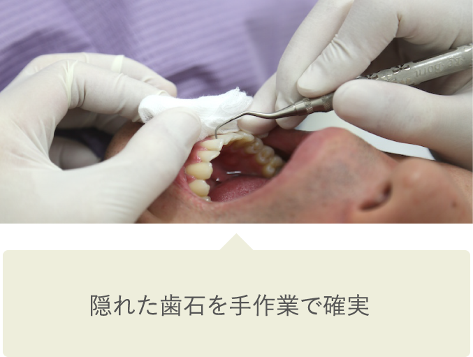 前回の検査結果とくらべて、治療方針を考えます。