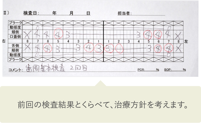 隠れた歯石を手作業で確実にとります。