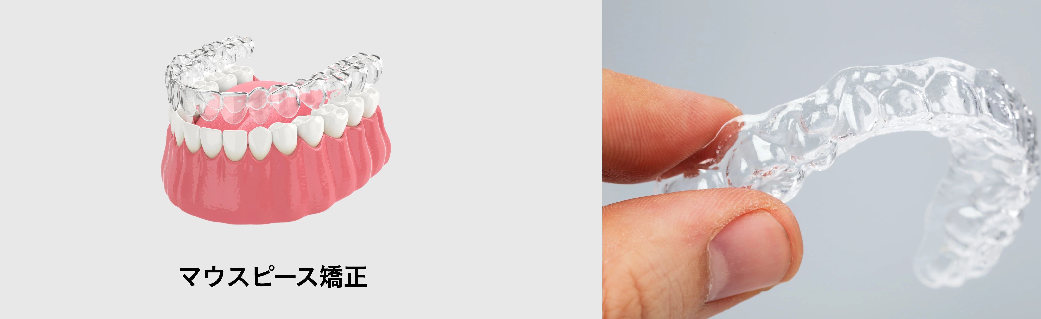 マウスピース矯正装置